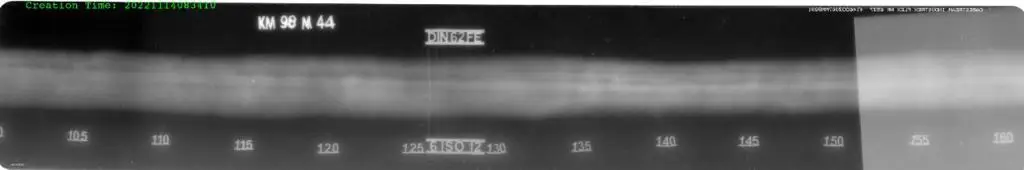 Computed Radiography sample image 3