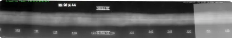 Computed Radiography sample image 3