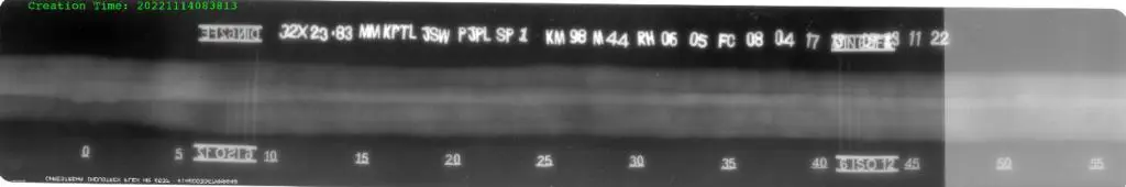 Computed Radiography sample image 6