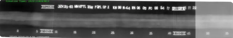 Computed Radiography sample image 6